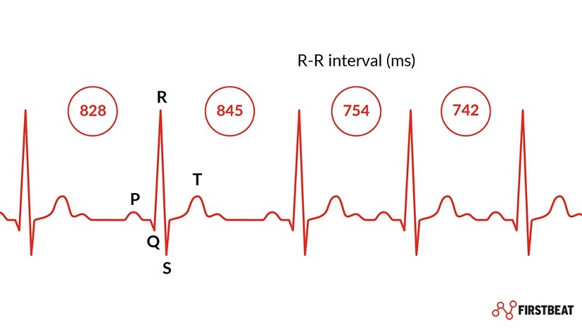 Graph of heart beat intervals