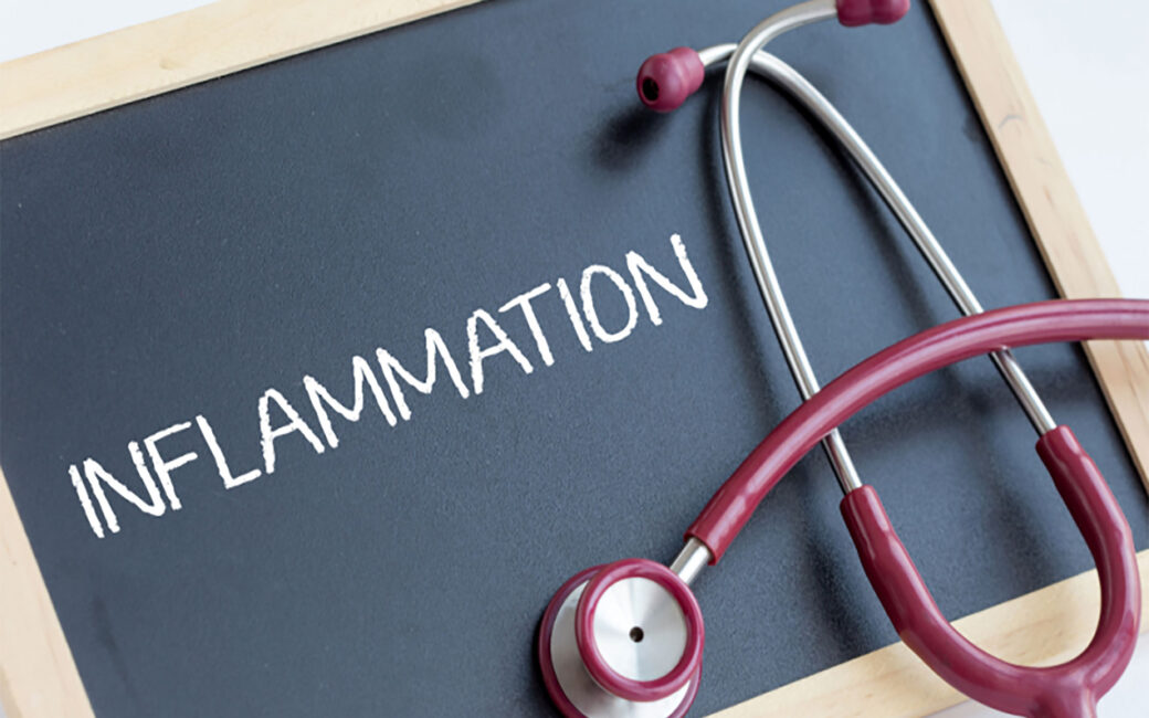 The dangers of chronic inflammation and what you can do about it